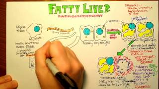 Fatty Liver Pathophysiology [upl. by Feigin]