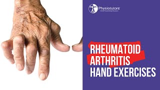 Rheumatoid Arthritis Hand Exercises  Mobility amp Strength [upl. by Medardas681]