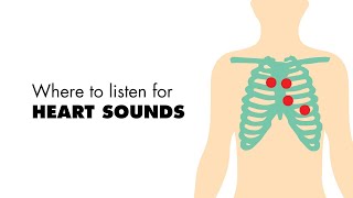 S3 and S4 Heart Sounds Auscultating Heart Sounds [upl. by Liederman319]