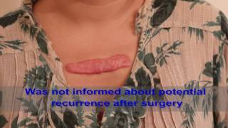 Chest Keloids  Mistakes to Avoid [upl. by Caryl]