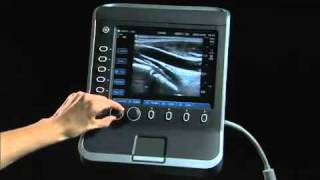 Sonosite S Series Product Training Part 1 System Overview [upl. by Brigit]